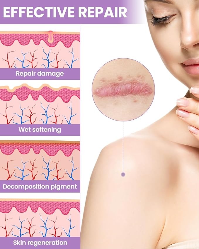 WOOKINGWA Silicone Scar Sheets - 1.6” x 120” Roll, Medical Grade Scar Tape, Non-Irritating Scar Removal Strips for Surgical Scars, Keloid, C-Section, Tummy Tuck, Burn, Acne